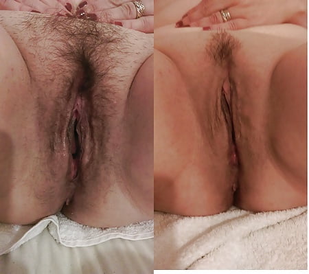 Shaving Cunt Before And After 18 Immagini XHamster