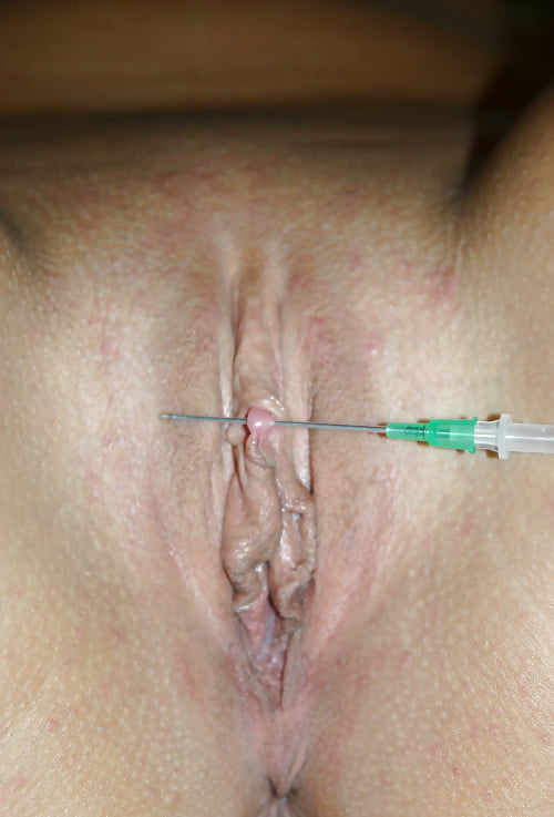 Needle Through Clitoris.