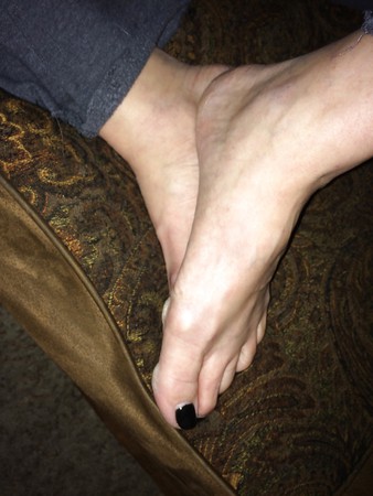 Wife's black toes