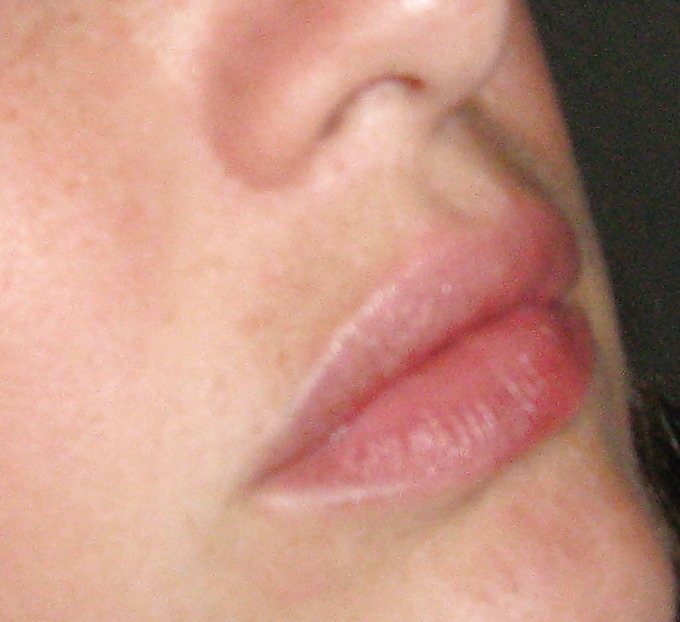 XXX Lips