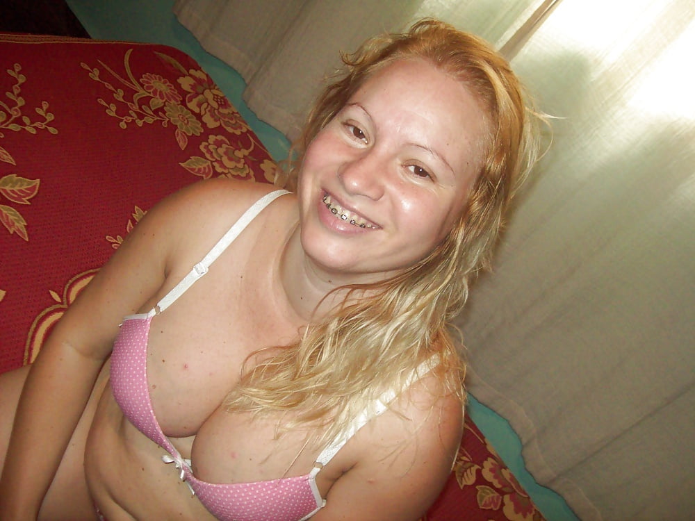 XXX Acne, Freckles and Spots Wank Bank