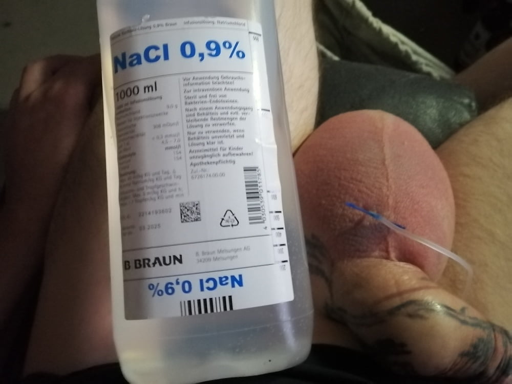 Saline Infusion In Scrotum Second 2 Liter 21 Pics Xhamster 8717