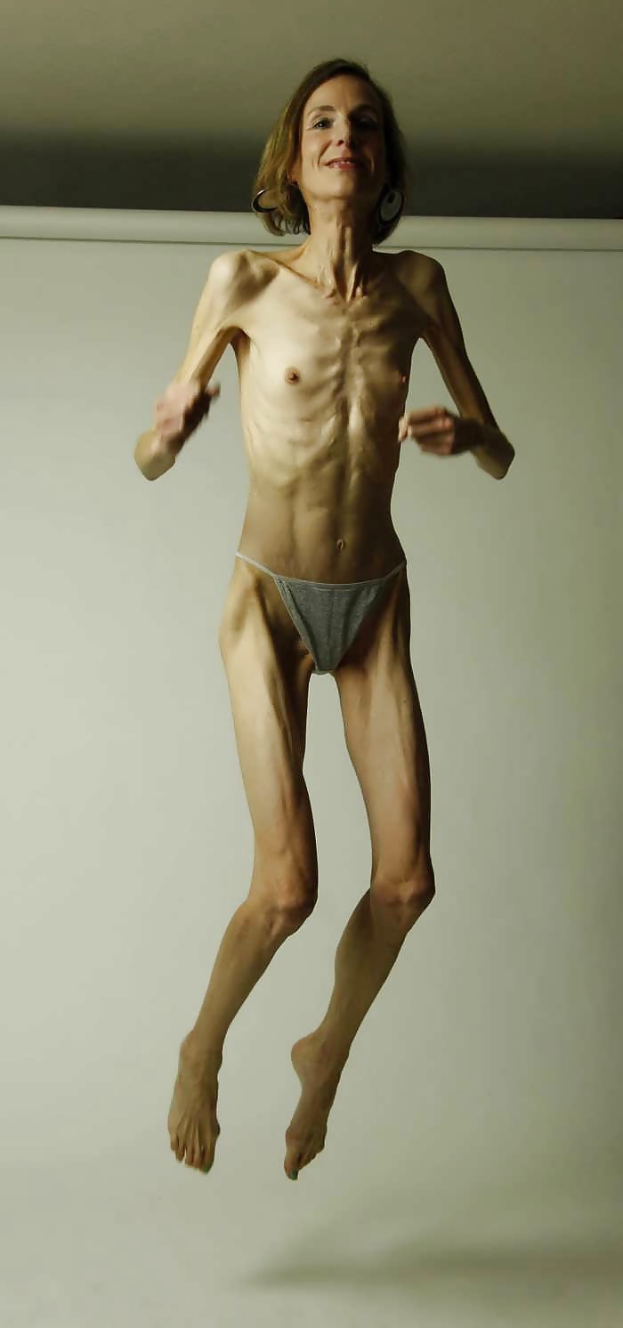 XXX More anorexic beauties