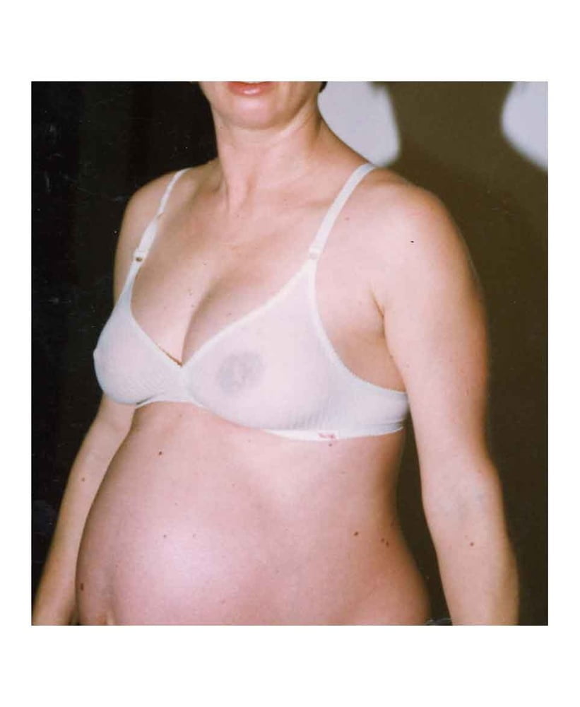 Pregnant - 5 Photos 