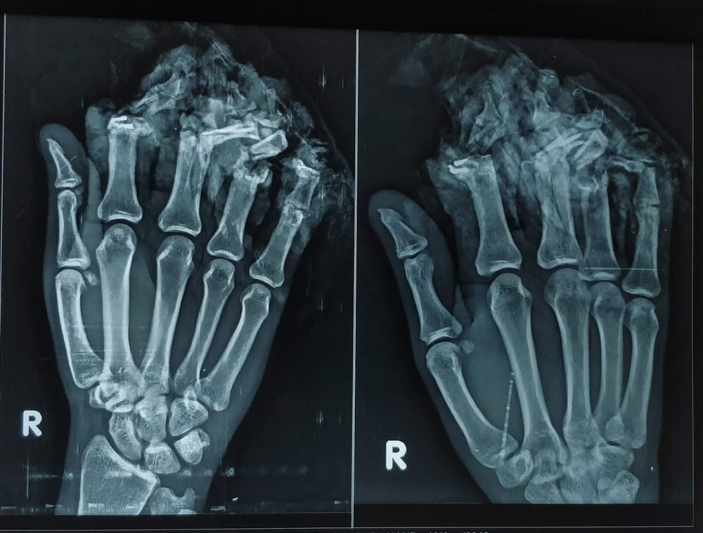 X-Ray- 15 Photos 
