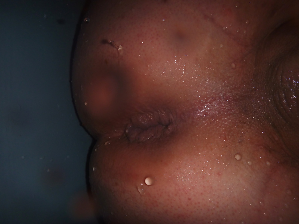 XXX anal fotze 3