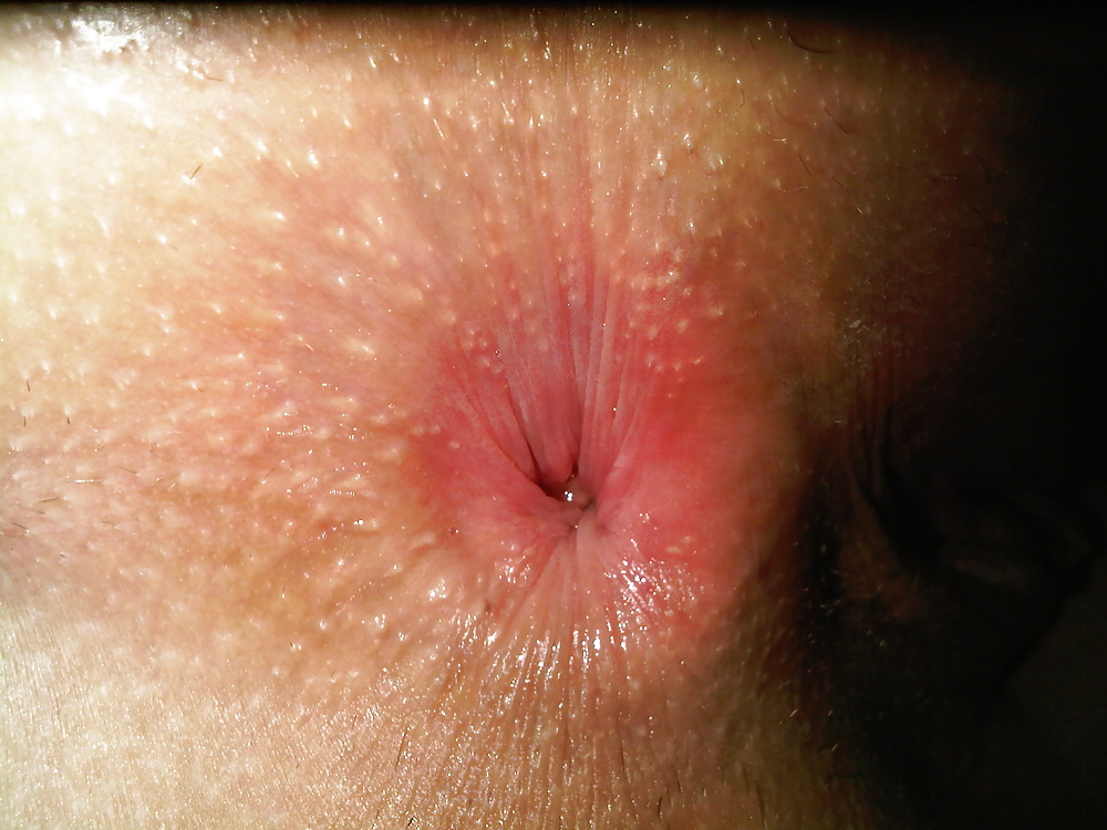 XXX Zuckersuesses Foetzchen