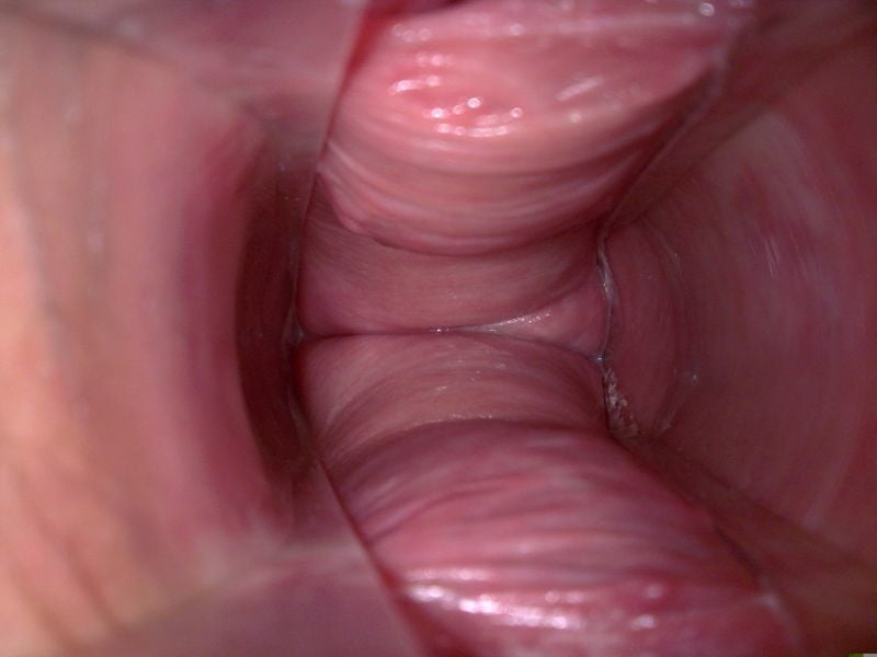 Camera inside vagina during sex xxgasm camera inside pussy.
