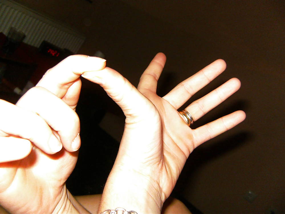 XXX Ola 's Hand - flexible double jointed thumd