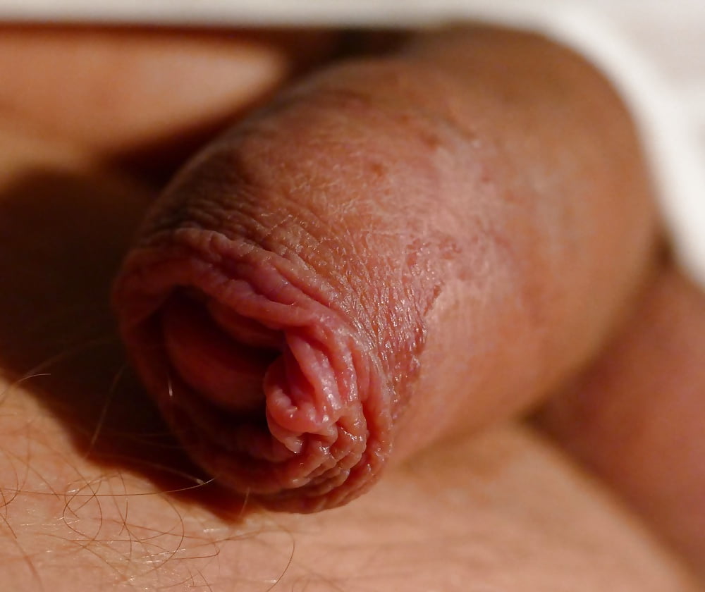 Close Up Uncut Cock Head And Slit 24 Pics Xhamster