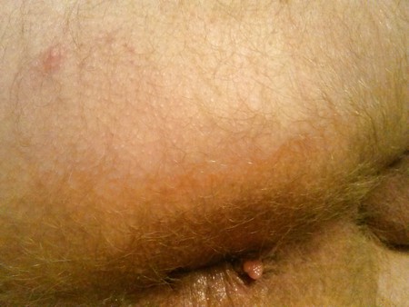 My hairy asshole and butt clit!