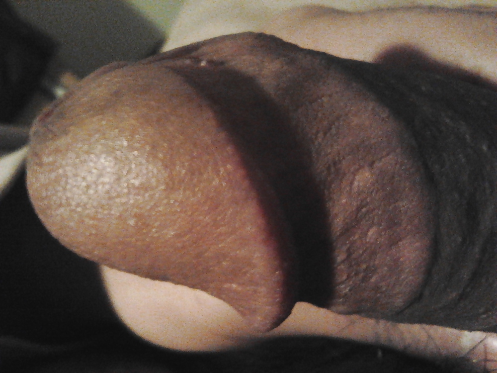 XXX My Penis