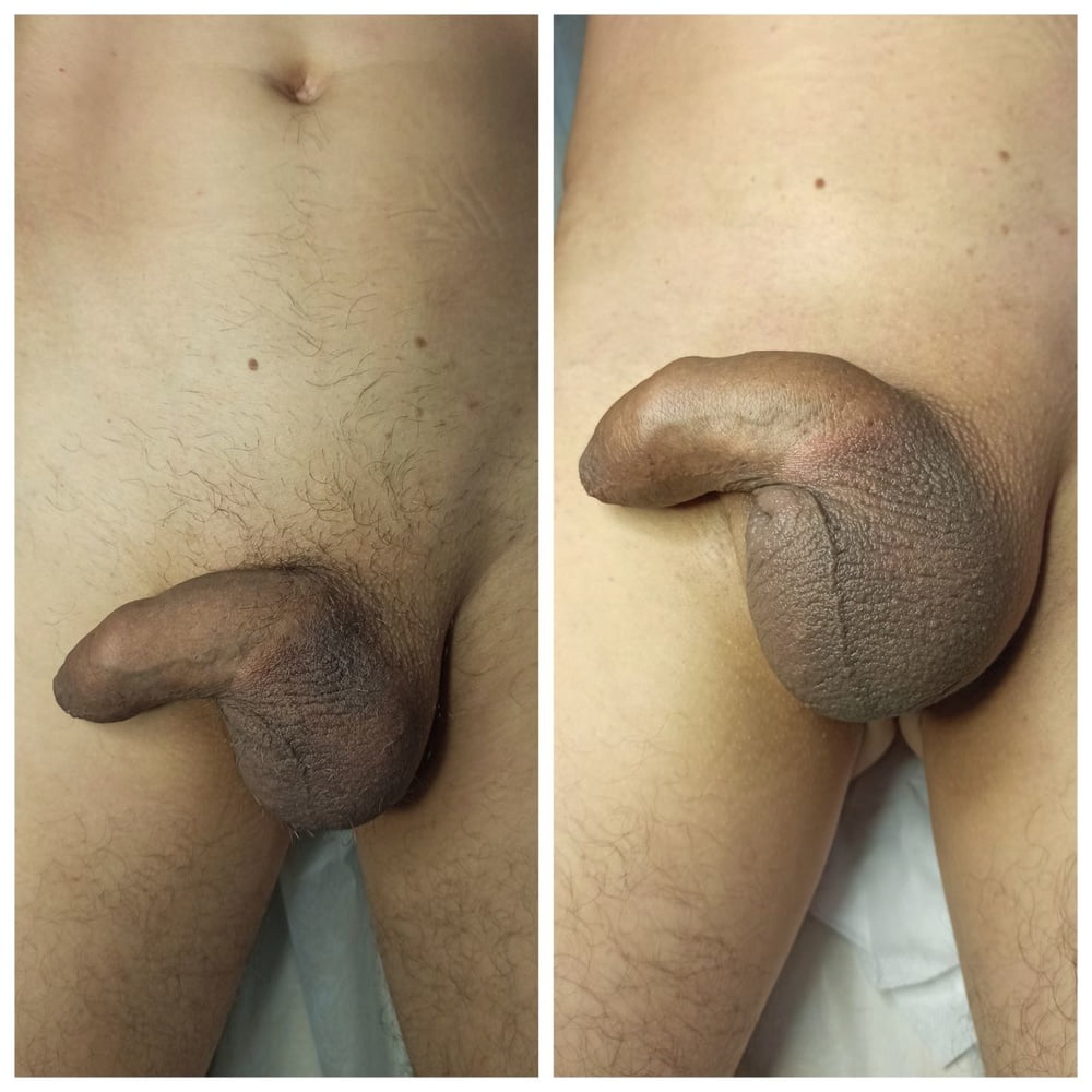 Look! After my procedure, all the dicks really got bigger!- 28 Photos 