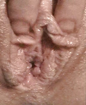 XXX another friend