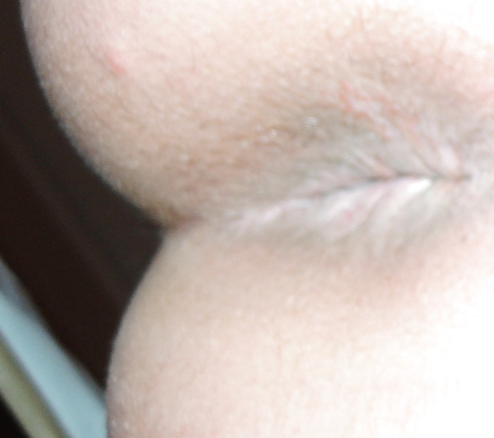 XXX Mixed pics of my butthole from 18 until now