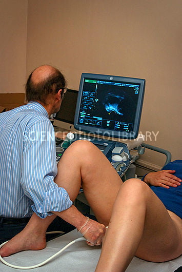 Transrectal ultrasound female