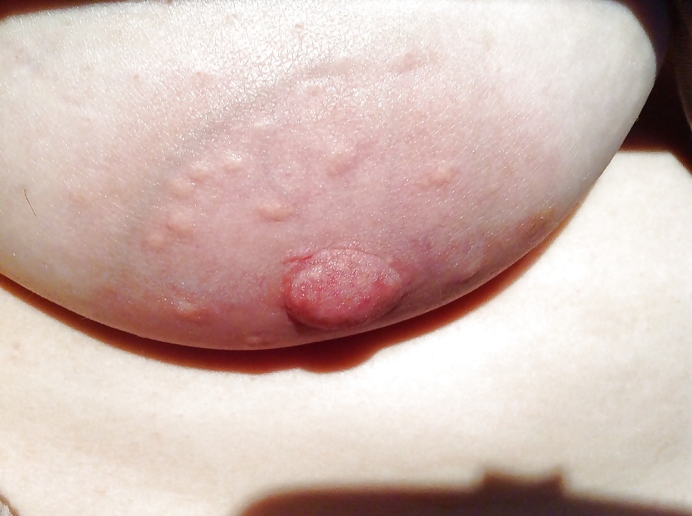 XXX Wife's saggy tit