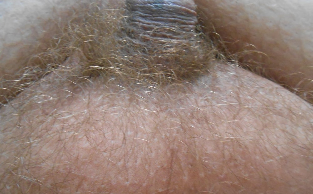 My Tiny Hairy Dick Before Shaving 8 Pics Xhamster 